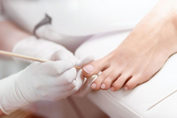 Pedicure